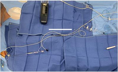 Direct wire pacing during measurement of fractional flow reserve: A randomized proof-of-concept noninferiority crossover trial
